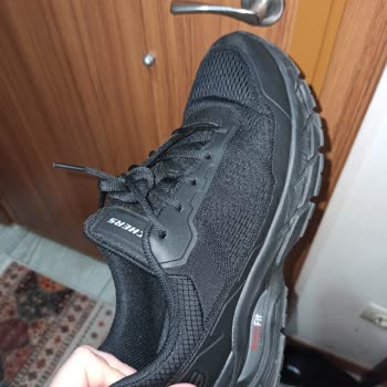 Skechers Marka Spor Ayakkabı Ayaklarımı Yaktı