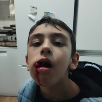 Nuh Çimento Ağız ve Diş Sağlığı Merkezi Diş Çekimi Şikayet