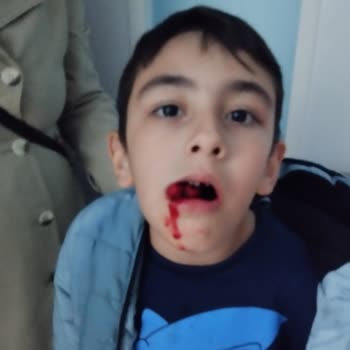 Nuh Çimento Ağız ve Diş Sağlığı Merkezi Diş Çekimi Şikayet