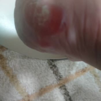 Tamer Tanca Ayakkabımda Yaşadığım Sorun Ve İsteğim
