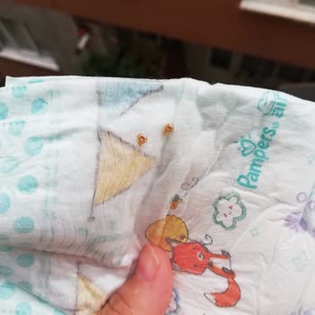 Prima Bebek Bezinden Sayısız Akrep Çıktı