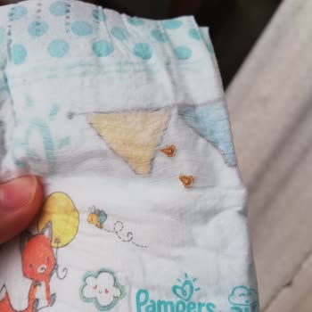 Prima Bebek Bezinden Sayısız Akrep Çıktı