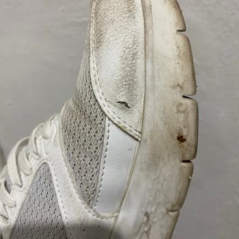 Skechers Ayakkabı Şikayetim Var.