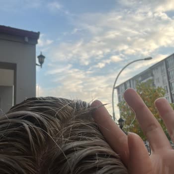 Hairport Kuaför Kuaförde Saçlarım Yandı