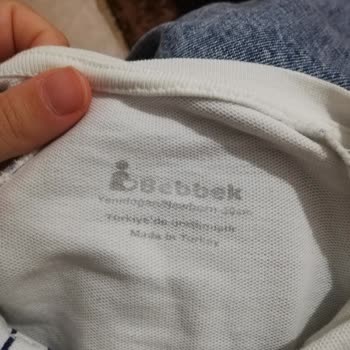 Ebebek Tulumun Rengi Çocuğumun Vücuduna İz Yapıyor