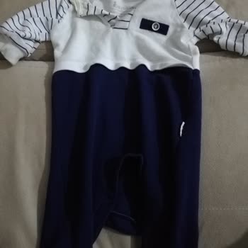 Ebebek Tulumun Rengi Çocuğumun Vücuduna İz Yapıyor