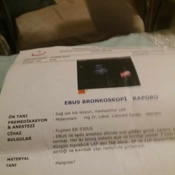 Sağlık Bakanlığı Biyopsi Sonucu Alınamaması