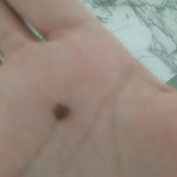 Eti Gıda Eti İçibol Kabuk Çıkması