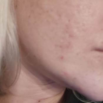 The Purest Solutions The Purest Solution Cildi Mi Bozdu