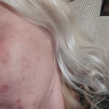 The Purest Solutions The Purest Solution Cildi Mi Bozdu