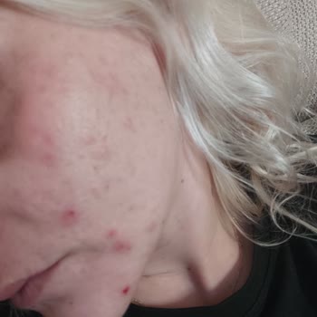 The Purest Solutions The Purest Solution Cildi Mi Bozdu