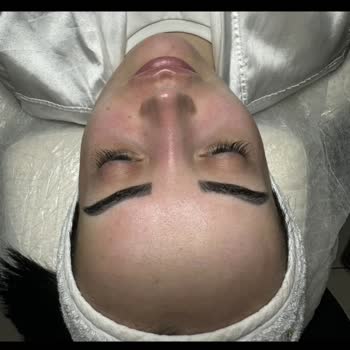 Bade Medikal & Cerrahi Estetik Danışmanlığı Çene Ve Dudak Dolgusu