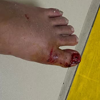 Selectum Family Resort Side Tatilim Zindan Oldu Sakatlandım