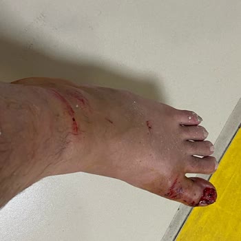 Selectum Family Resort Side Tatilim Zindan Oldu Sakatlandım