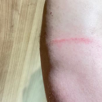 Hummel Mağaza Ürün Sergileme Platformlarının Tehlikesi
