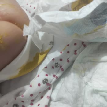 Molfix 2 Numara Bebek Bezi Her Seferinde Taşırıyor