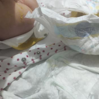 Molfix 2 Numara Bebek Bezi Her Seferinde Taşırıyor