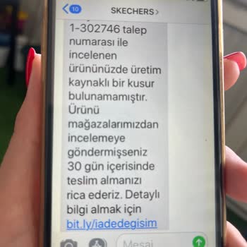 Skechers Yırtılma Ve Değişim Problemi