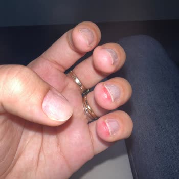 Aymira Koçaklı Yaşam Merkezi Tırnaklarım Çok Kötü Oldu