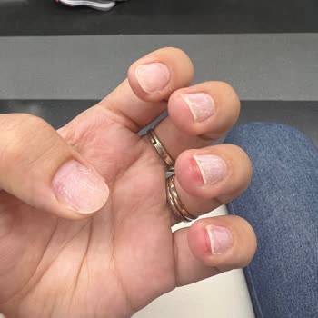 Aymira Koçaklı Yaşam Merkezi Tırnaklarım Çok Kötü Oldu