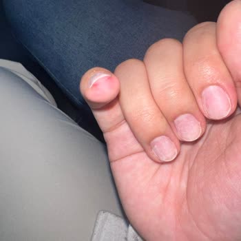 Aymira Koçaklı Yaşam Merkezi Tırnaklarım Çok Kötü Oldu