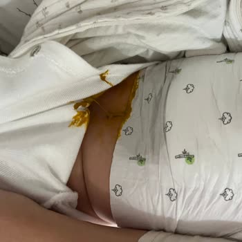 Sleepy Bebek Bezi Sızdırma Yapıyor