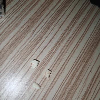 Toblerone Çikolatasından Çıkan Taş Gibi Şeker