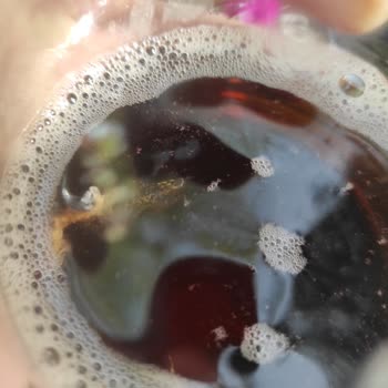 Didi İçinden Çıkan İpliksi Bir Şey