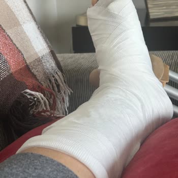 İzelman Otopark Peyzajı Nedeni Kırılan Ayağım