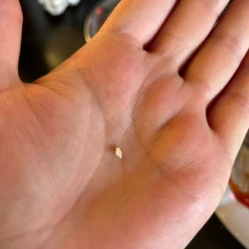 Köfteci Yusuf Köfteden Kemik Çıktı