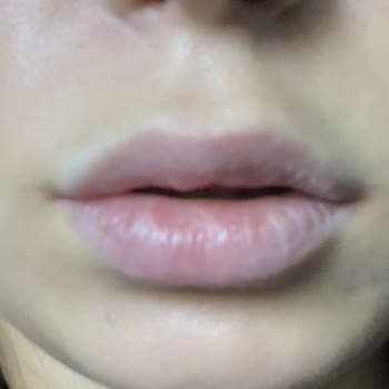 Narcissa Clinic Memnun Değilim