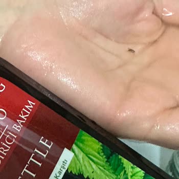 Tresan Şampuanın İçinden Böcek Çıktı