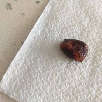 Kahve Dünyası Drajeden Kıl Çıktı