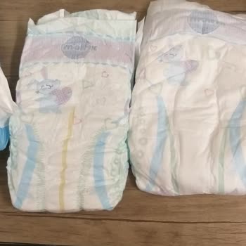 Molfix Bebek Bezi Orijinalliği Şüpheli