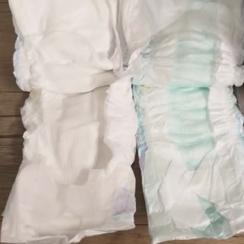 Molfix Bebek Bezi Orijinalliği Şüpheli