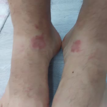 FLO Ayakkabı FLO Ürünlerine Sahip Çıkmıyor