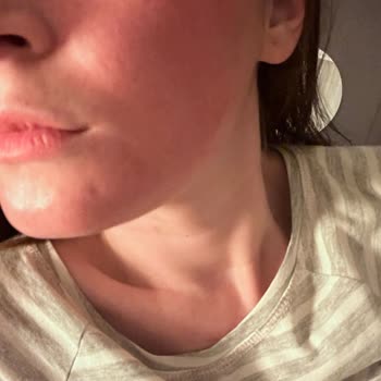 The Purest Solutions The Purest Kırmızı