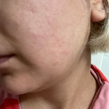 Yves Rocher Ürünlerinin Cilde Vermiş Olduğu Zarar!