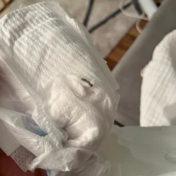 Molfix Bebek Bezi İçinde Parça Çıktı