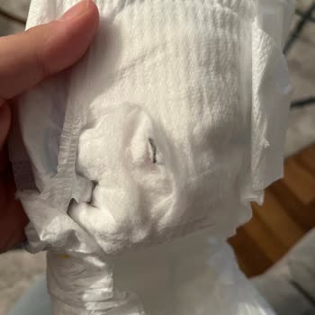 Molfix Bebek Bezi İçinde Parça Çıktı