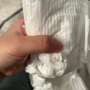 Molfix Bebek Bezi İçinde Parça Çıktı