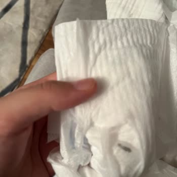 Molfix Bebek Bezi İçinde Parça Çıktı