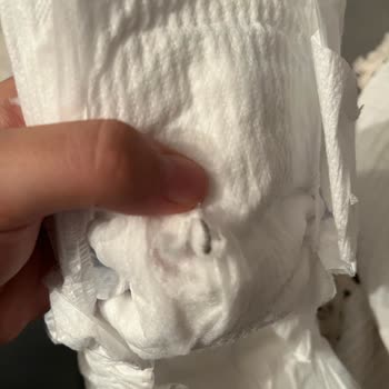 Molfix Bebek Bezi İçinde Parça Çıktı