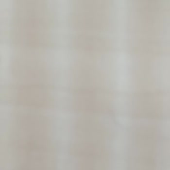 Xiaomi Kameram Bir Anda Karıncalanmaya Başladı