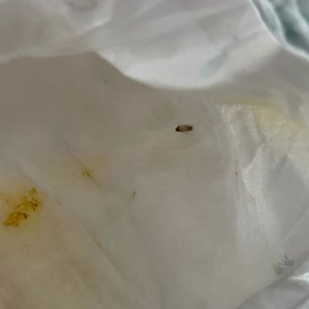 Hepsiburada Bebek Bezinden Kurt Çıktı