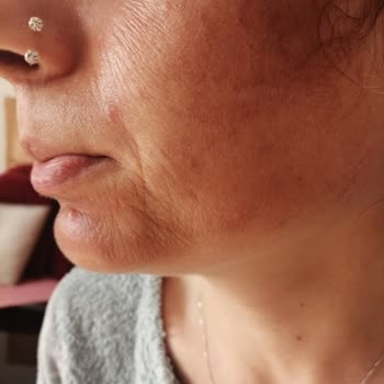 Tiabella Güzellik Yanlış İşlem Uygulayıp, Yanlış Tedavi Kremlerini Sattılar