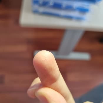 Kızılay Maden Suyundan Cam Parçası Çıktı