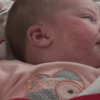 Mustela Bebeğimde Alerji Yaptı