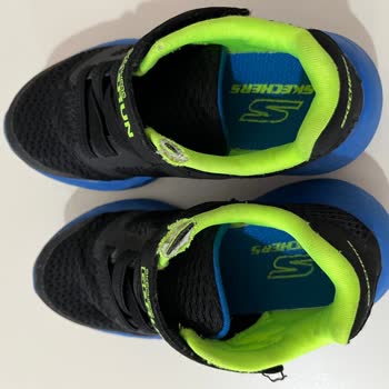 Skechers Ayakkabının 1 Aylık Kısa Ömrü Ve Hayal Kırıklığımız