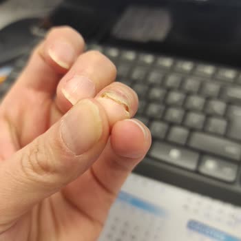 Aymira Koçaklı Yaşam Merkezi Aymira Koçaklı Güzellik Merkezi Tırnak